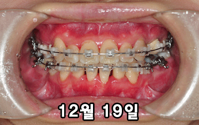 1219TT.gif