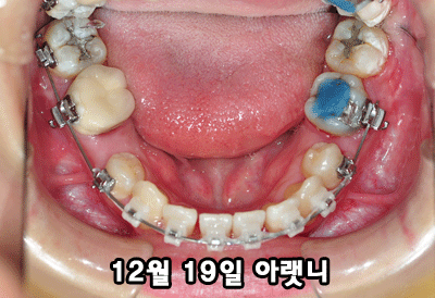 1219TT4.gif