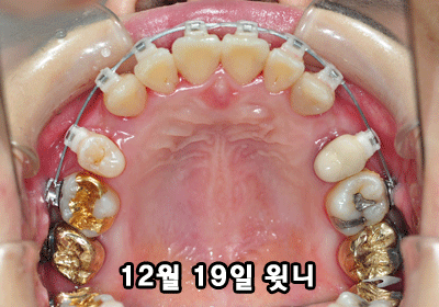 1219TT3.gif