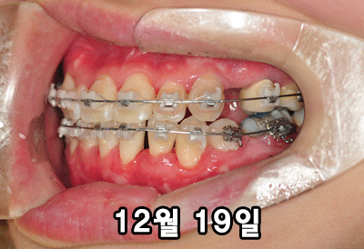 1219ㅅㅅ2.gif