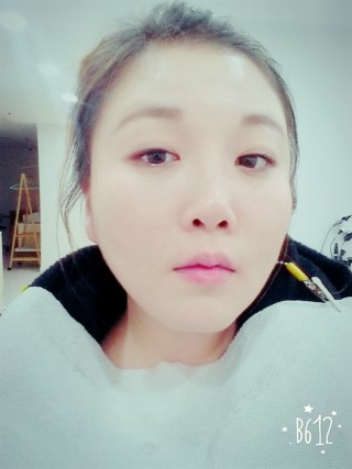 치아교정후기04.jpg