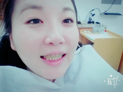 치아교정후기01.jpg