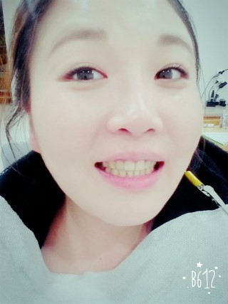 치아교정후기02.jpg