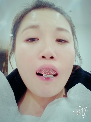 치아교정후기05.jpg