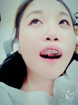 치아교정후기03.jpg