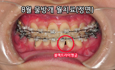 201508junghhh.jpg