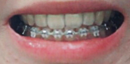 01.jpg