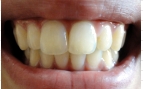 2008_00001.jpg