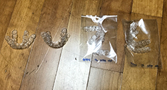 치아교정후기02.jpg