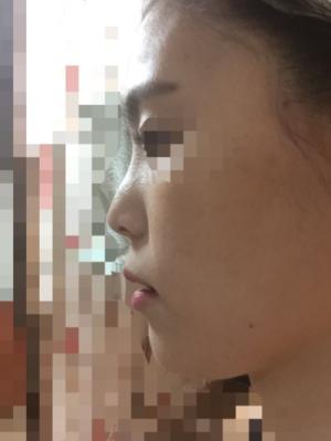 옆모습.jpg