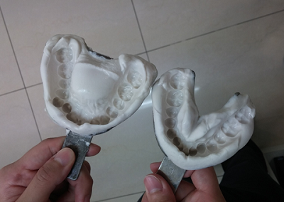 턱관절교정후기2.png