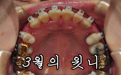 0305up.jpg