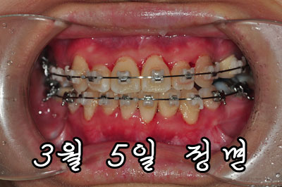 0305jung.jpg
