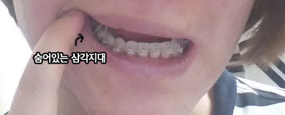 hhh0504tri02.jpg