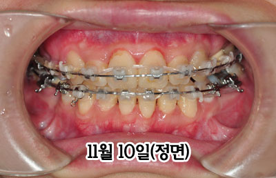 jung1110h.jpg