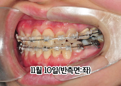 left1110h.jpg