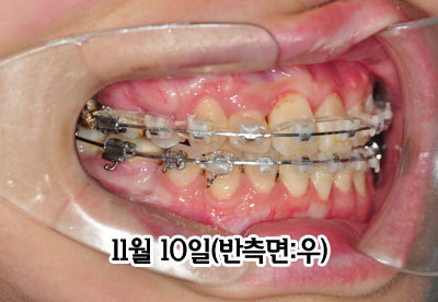 right1110h.jpg