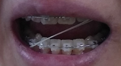 20141107_104451.jpg