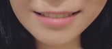 크기변환_치아교정후기01 (3).jpg