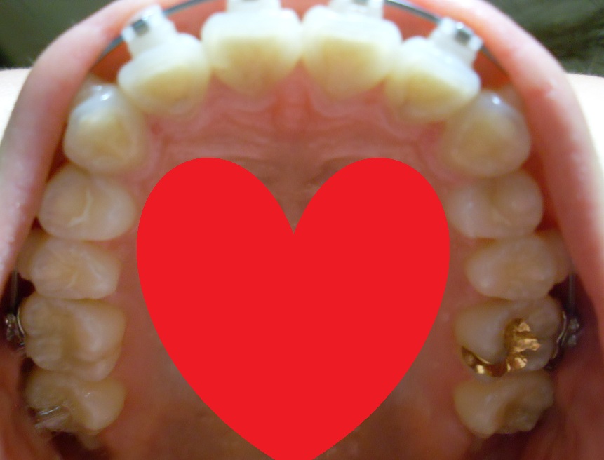 SDC12685.JPG