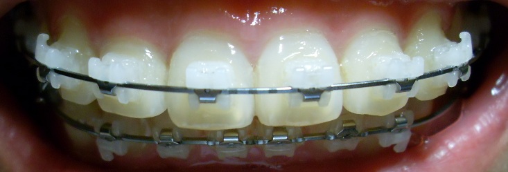 SDC12686.JPG