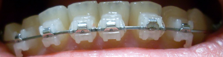SDC12680.JPG