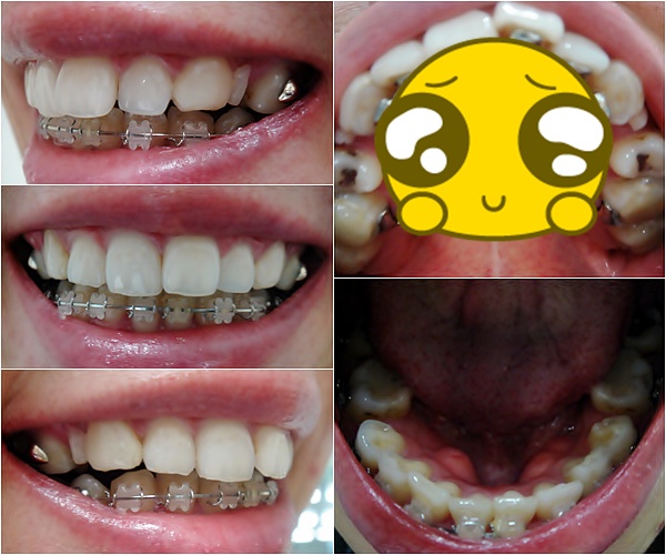16.킬본교정.jpg
