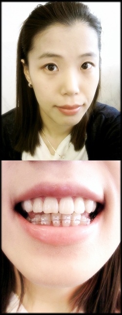 교정135일째^^.jpg