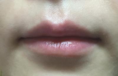 18_160221_입술사진.jpg