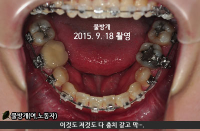 201509downhhh.jpg