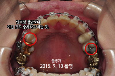201509uphhh.jpg