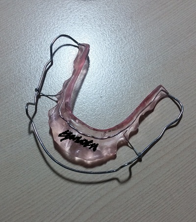턱관절치아교정후기27-1화사진8.jpg