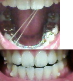 20111030210411_65818843.jpg