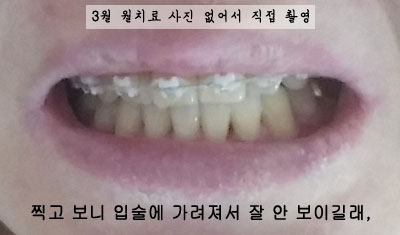 201603junghhh1.jpg
