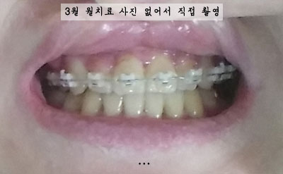 201603junghhh2.jpg