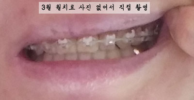201603lefthhh.jpg