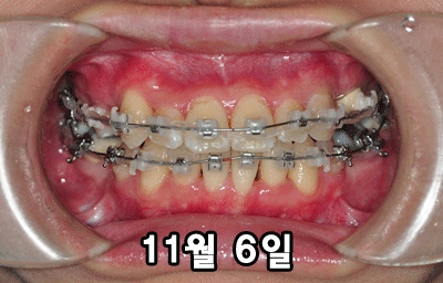 1106dkvsl.gif