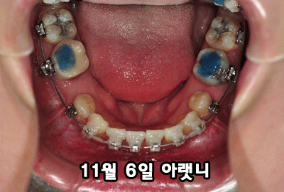 1106dkfotsl.gif