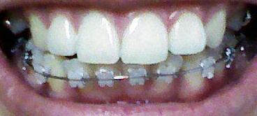 IMG2066-1.jpg