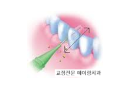 오라픽스 치아교정 포스팅(4).png