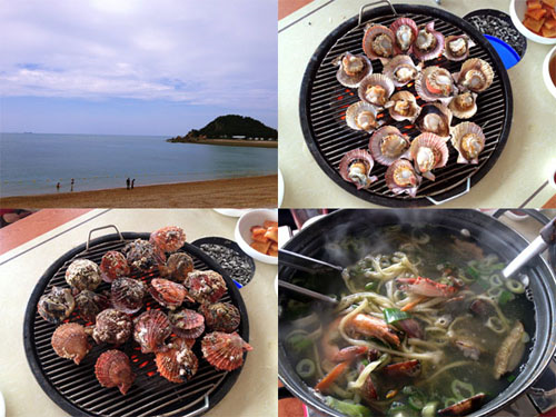 치아교정후기5.png