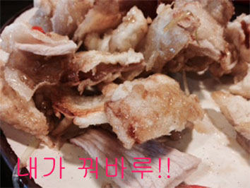 치아교정후기6.jpg