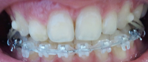 2011-10-07 08.59.23.jpg
