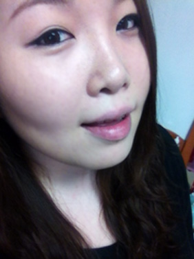 치아교정001.JPG
