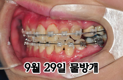 left0929hhh.jpg