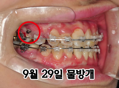 right0929hhh.jpg