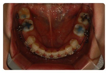 DSC_9399.jpg