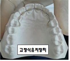 고정식유지장치.jpg