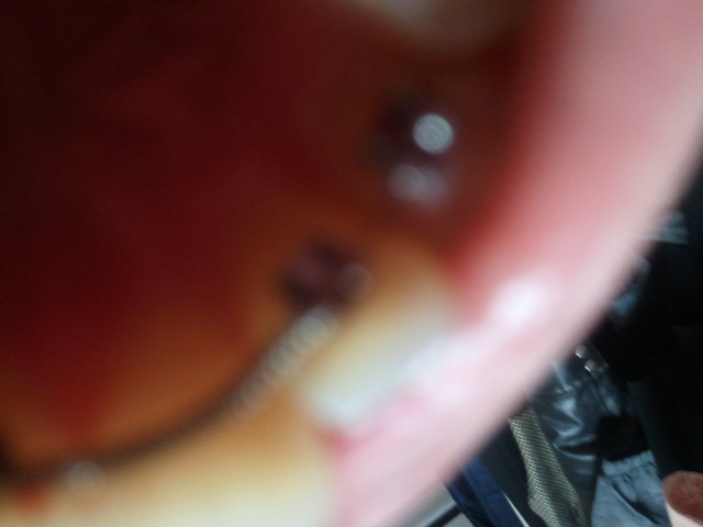 2011-04-15 20.01.41.jpg