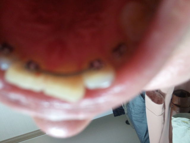 2011-04-15 20.09.23.jpg
